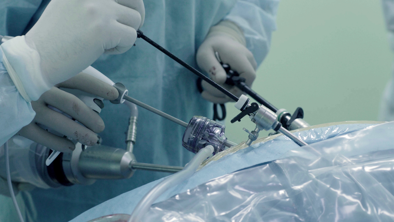 Minimally invasive urology surgery